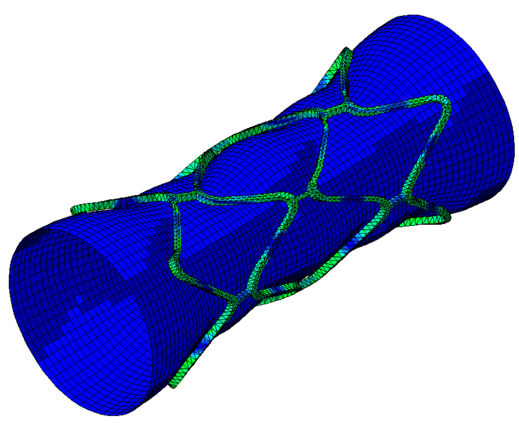 Live Life Time Product and Healing Prediction - Smart Stent